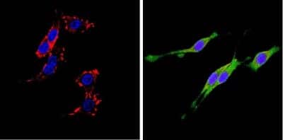 Immunocytochemistry/ Immunofluorescence: DPPIV/CD26 Antibody (236.3) - Azide and BSA Free [NBP2-22434]