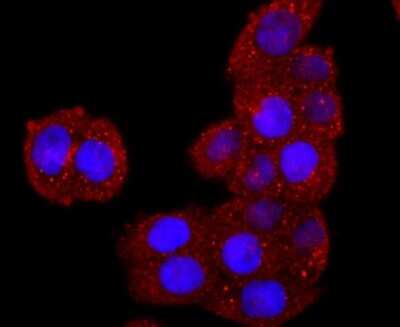 Immunocytochemistry/ Immunofluorescence: DPPIV/CD26 Antibody (JM11-42) [NBP2-78791]
