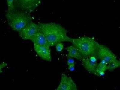 Immunocytochemistry/ Immunofluorescence: DPPIV/CD26 Antibody (OTI11D7) - Azide and BSA Free [NBP2-70588]