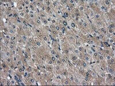 Immunohistochemistry: DPPIV/CD26 Antibody (OTI11D7) - Azide and BSA Free [NBP2-70588]