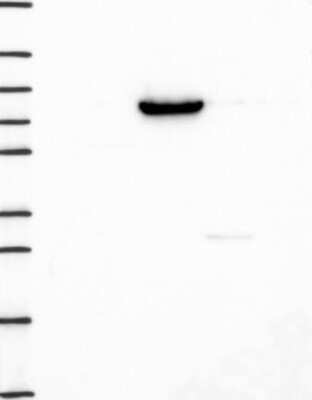 Western Blot: DPPIV/CD26 Antibody [NBP3-16980]