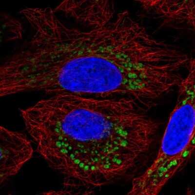 Immunocytochemistry/ Immunofluorescence: DPY19L2 Antibody [NBP2-56009]