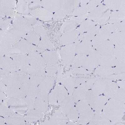Immunohistochemistry-Paraffin: DPY19L2 Antibody [NBP3-17123]