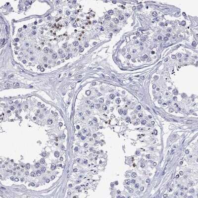Immunohistochemistry-Paraffin: DPY19L2 Antibody [NBP3-17123]