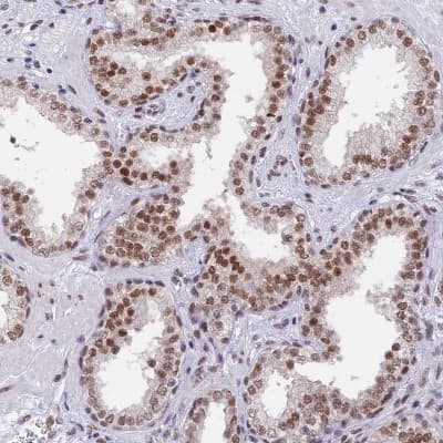 Immunohistochemistry-Paraffin: DPY30 Antibody [NBP1-91848]