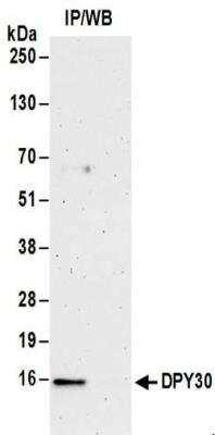 Immunoprecipitation: DPY30 Antibody [NBP2-32201]