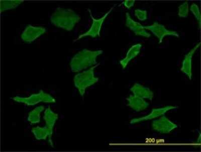 Immunocytochemistry/ Immunofluorescence: DPYD Antibody (7D4) [H00001806-M01]