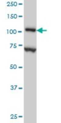 Western Blot: DPYD Antibody (7D4) [H00001806-M01]
