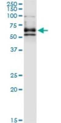 Immunoprecipitation: DPYSL4 Antibody (1F5) [H00010570-M01]