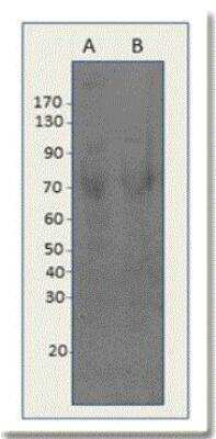 Western Blot: DPYSL4 Antibody [NBP2-11055]