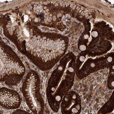 Immunohistochemistry-Paraffin: DQX1 Antibody [NBP1-91849]