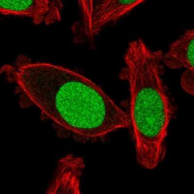 Immunocytochemistry/ Immunofluorescence: DR1 Antibody [NBP2-47480]