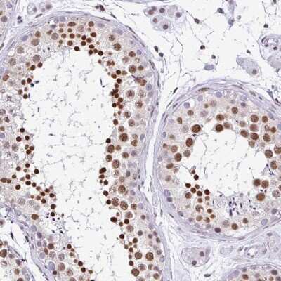 Immunohistochemistry-Paraffin: DR1 Antibody [NBP2-47480]