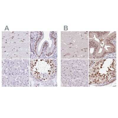 Immunohistochemistry-Paraffin: DR1 Antibody [NBP2-47480]
