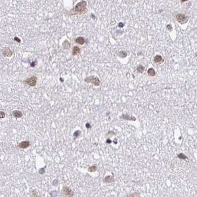 Immunohistochemistry-Paraffin: DR1 Antibody [NBP2-47480]