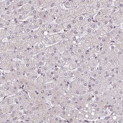 Immunohistochemistry-Paraffin: DR1 Antibody [NBP2-48979]