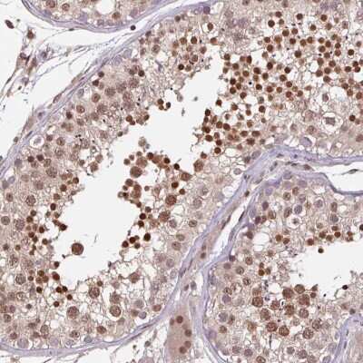 Immunohistochemistry-Paraffin: DR1 Antibody [NBP2-48979]
