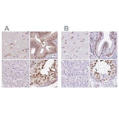 Immunohistochemistry-Paraffin: DR1 Antibody [NBP2-48979]