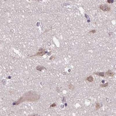 Immunohistochemistry-Paraffin: DR1 Antibody [NBP2-48979]