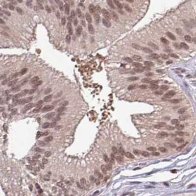 Immunohistochemistry-Paraffin: DR1 Antibody [NBP2-48979]