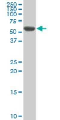 Western Blot: DRAK1 Antibody (3G8) [H00009263-M02]