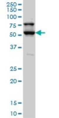 Western Blot: DRAK1 Antibody (4D12) [H00009263-M03]