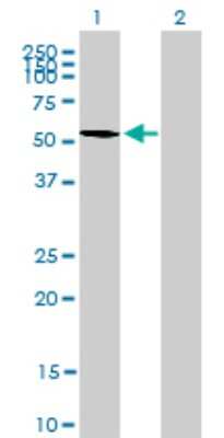 Western Blot: DRAK1 Antibody (4D12) [H00009263-M03]
