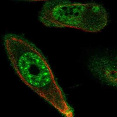 Immunocytochemistry/ Immunofluorescence: DRAK1 Antibody [NBP2-55328]