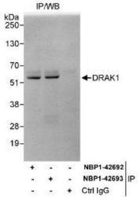 Immunoprecipitation: DRAK1 Antibody [NBP1-42692]