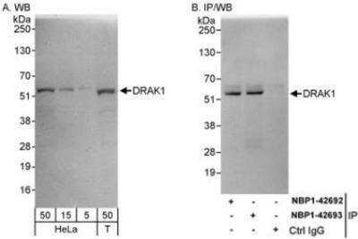 Western Blot: DRAK1 Antibody [NBP1-42693]