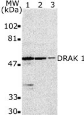 Western Blot: DRAK1 AntibodyBSA Free [NBP1-76896]