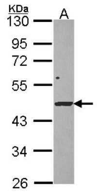 Western Blot: DRAK1 Antibody [NBP2-16224]
