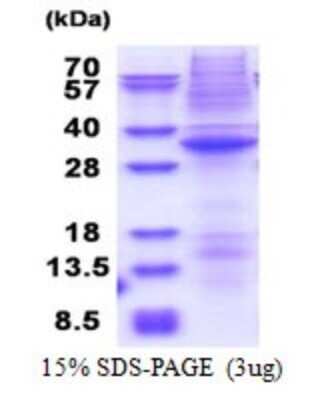 SDS-PAGE: Recombinant Human DRAK1 His Protein [NBP2-51620]