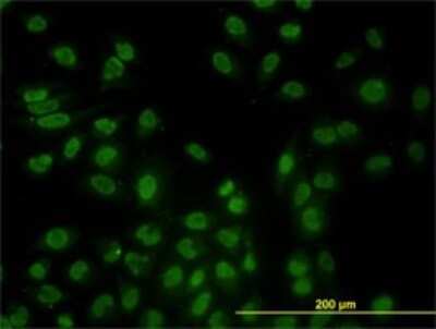 Immunocytochemistry/ Immunofluorescence: DRAK2 Antibody (2C3) [H00009262-M01]