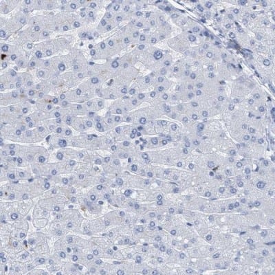 Immunohistochemistry-Paraffin: DRAM2 Antibody [NBP1-93463]