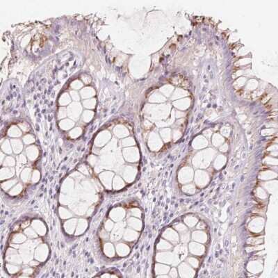 Immunohistochemistry-Paraffin: DRAM2 Antibody [NBP2-49345]