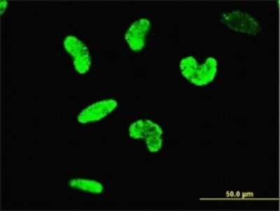 Immunocytochemistry/ Immunofluorescence: DRIL1 Antibody (1A11) [H00001820-M01]