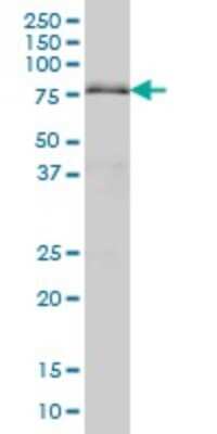Western Blot: DRIL1 Antibody (1A11) [H00001820-M01]