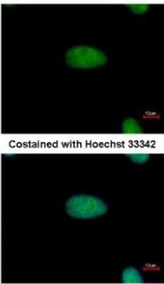 Immunocytochemistry/ Immunofluorescence: DRIL1 Antibody [NBP2-16228]