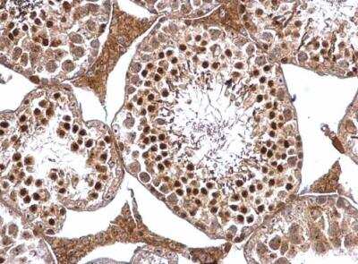 Immunohistochemistry-Paraffin: DRIL1 Antibody [NBP2-16228]
