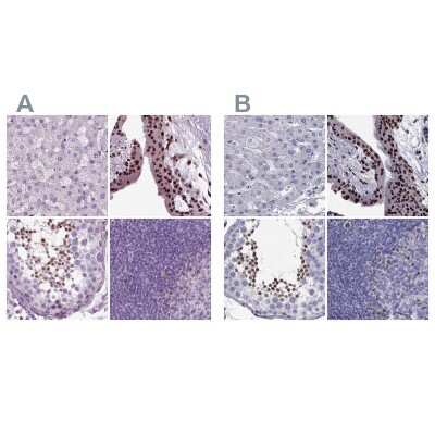 Immunohistochemistry-Paraffin: DRIL1 Antibody [NBP2-62705]
