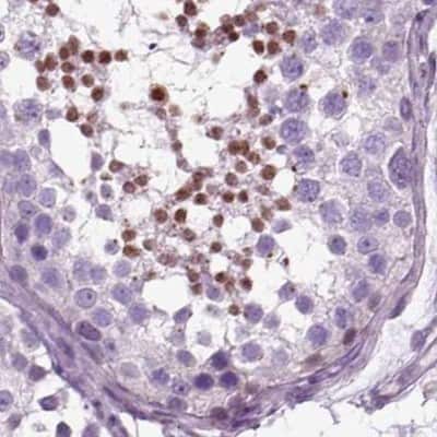Immunohistochemistry-Paraffin: DRIL1 Antibody [NBP2-62705]