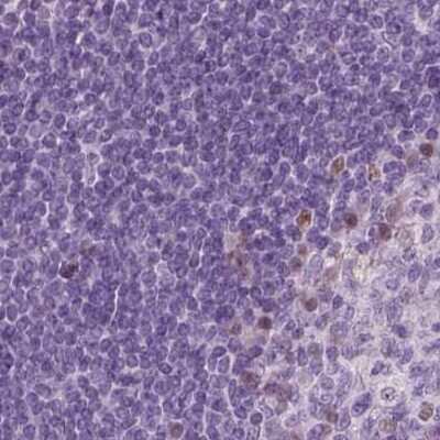 Immunohistochemistry-Paraffin: DRIL1 Antibody [NBP2-62705]
