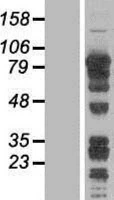 Western Blot: DRIL1 Overexpression Lysate [NBL1-07684]