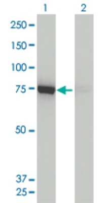 Western Blot: DRP1 Antibody (3B5) [H00010059-M01]