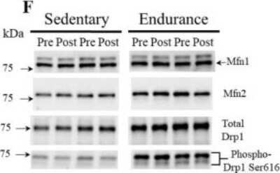Western Blot: DRP1 AntibodyBSA Free [NB110-55288]