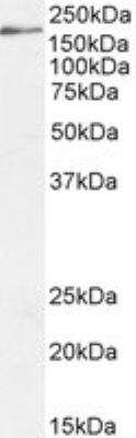 Western Blot: DSCAM Antibody [NB100-41390]