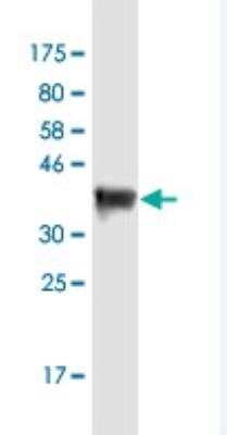 Western Blot: DSCAM-L1 Antibody (6B10) [H00057453-M01-100ug]