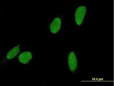 Immunocytochemistry/ Immunofluorescence: DSCC1 Antibody [H00079075-B01P]