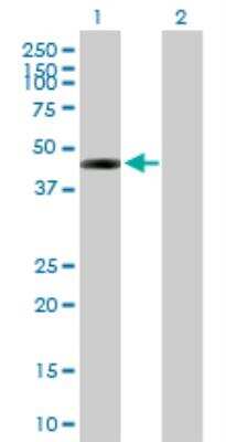 Western Blot: DSCC1 Antibody [H00079075-B01P]